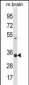 STX2 Antibody (Center)