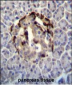 STXBP3 Antibody (Center)