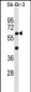 STXBP3 Antibody (Center)