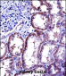 IL6 Antibody (Center)
