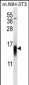 APG8b(MAP1LC3B) Antibody (N-term T29)