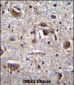 MAPK14 Antibody (Center T180/Y182)