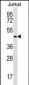 MAPK14 Antibody (Center T180/Y182)