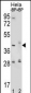 HYAL2 Antibody (Center)