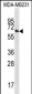 GBP1 Antibody (N-term)