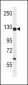 PC Antibody (N-term)