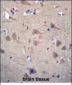 CCT8 Antibody (C-term)