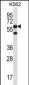 CCT8 Antibody (C-term)