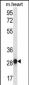 MYOGENIN Antibody (N-term)