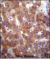 HSD17B4 Antibody (Center)