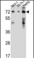 HSD17B4 Antibody (Center)