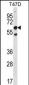 SCP2 Antibody (N-term)