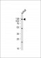 GAA Antibody (N-term)