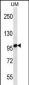 STIM2 Antibody (N-term)