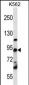 UBTF Antibody (C-term)