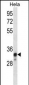 NDUFS8 Antibody (Center)