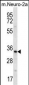 PEX14 Antibody (Center)