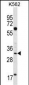 FCN3 Antibody (C-term)