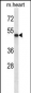 ABI2 Antibody (N-term)