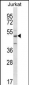 ABI2 Antibody (N-term)