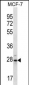 PSMB10 Antibody (C-term)