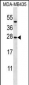 KLRC1 Antibody (N-term)
