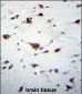 PREX1 Antibody (C-term)