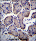 RPL23 Antibody (Center)