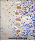 GP111 Antibody (Center)