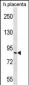 GP111 Antibody (Center)