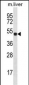 HOXD10 Antibody (C-term)