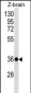 HOXD10 Antibody (C-term)