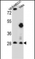 EIF4H Antibody (Center)