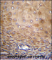 TMEM43 Antibody (Center)