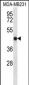 TMEM43 Antibody (Center)