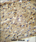 ABCD2 Antibody (C-term)