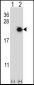 EIF4EBP1 Antibody (Center)