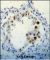 CDKN2B Antibody (C-term)