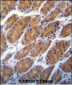 CLDN2 Antibody (C-term Y195)