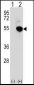 IRF4 Antibody (Center)