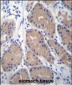 CA1 Antibody (N-term)