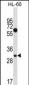 MED8 Antibody (Center)