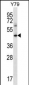 IFNGR1 Antibody (C-term)