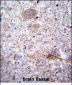 PCDHA7 Antibody (Center)