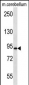 APBA2 Antibody (Center)