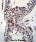 CCDC58 Antibody (N-term)