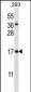 CCDC58 Antibody (N-term)