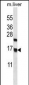 CCDC58 Antibody (N-term)