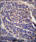 CA6 Antibody (C-term)