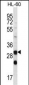 CA6 Antibody (C-term)